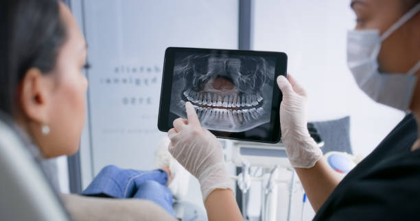 Licensed Teeth Whitening service in Chula Vista, CA - Smile Center Dentistry
